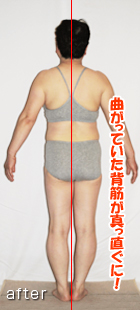 曲がっていた背筋が真っ直ぐに! after