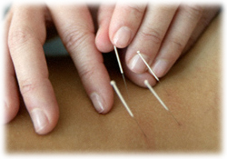 �I���ÃC���[�W