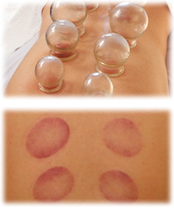 �z�ʎ��ÃC���[�W